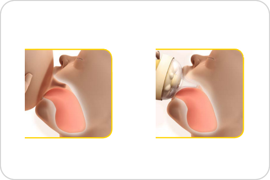 Medela Zestaw Calma Podawanie pokarmu z butelką 150 ml